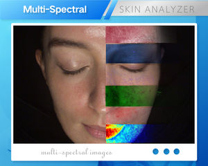 Analizador de Piel Inteligente con IA MC88, Tecnología de Topografía 3D, Análisis de Arrugas Faciales, Pigmentación y Acné, Pantalla iPad - Product Image 4