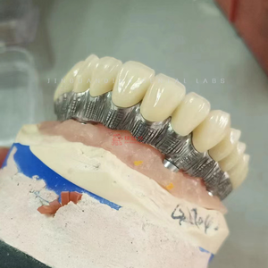 Ponte dentario contemporaneo dell'impianto ad arco pieno dentale a ponte di <span class=keywords><strong>Zirconia</strong></span> con qualità ottimale - Product Image 4