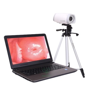 Colposcopio Digital Portátil Mini MY-F003 para Ginecología Médica para la Vagina - Product Image 1