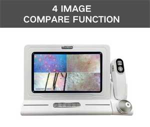 Advanced 11 Inch Trichoscope Camera for Dandruff and Oily Scalp Diagnosis | Clinical Grade Hair Density Tester & Skin Analyzer. - Product Image 2