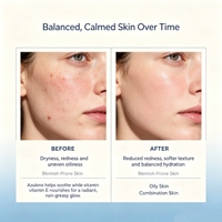 Label privé Soins de la peau naturels biologiques Huile de tanaisie éclaircissante Lapis Blue Huile apaisante pour le visage
