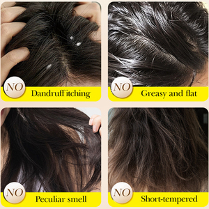 Barra de Champú Natural de Café, Jabón Sólido Anticaída del <span class=keywords><strong>Cabello</strong></span>, <span class=keywords><strong>para</strong></span> Control de Grasa y Anticaspa, <span class=keywords><strong>para</strong></span> <span class=keywords><strong>el</strong></span> Cuidado Diario del <span class=keywords><strong>Cabello</strong></span> - Product Image 3