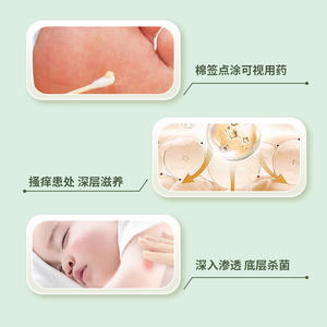 Crème de soin médicale Tongrentang, taille standard, pour peaux sensibles, soulagement de la dermatite, de l'eczéma et de l'acné, pour bébés et enfants - Product Image 2