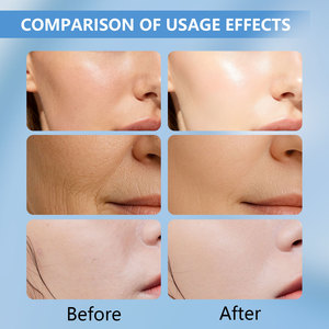 Crème Visage en Gelée à l'Acide Hyaluronique Personnalisée en Usine, Hydratation Profonde, Niacinamide Améliore les Rougeurs et les Peaux Sensibles - Product Image 5
