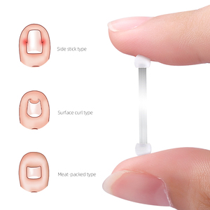 Kit di Correzione <span class=keywords><strong>Unghie</strong></span> <span class=keywords><strong>Incarnite</strong></span> in Acciaio Inossidabile, Strumento <span class=keywords><strong>per</strong></span> Pedicure e Cura dei Piedi - Product Image 3