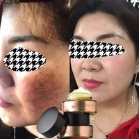Crème Correctrice Anti-Taches Pigmentaires OEM pour le Visage, Éliminateur de Mélasma, Soin de la Peau Noire, Crème Éclaircissante Anti-Taches Noires