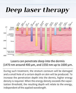 Dissolvant de rides 12d lifting peau serrant la machine d'élimination des rides 1470nm Diode Laser Machine - Product Image 5
