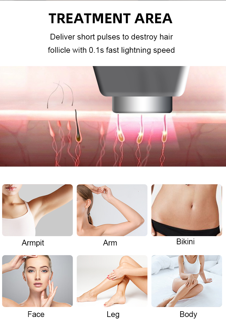 Astiland Fiber Laser 3 Wavelength 755 / 1064 / 808nm Laser Hair Removal Machine