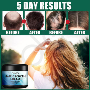 Oalen, venta al por mayor, crema para el crecimiento del cabello, aceite de árbol de té de acción rápida vegano orgánico, nutritivo, refrescante, tratamiento para la pérdida de cabello, muestra gratis - Product Image 6