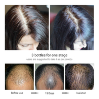 LANBENA — huile essentielle de croissance des cheveux, sérum de traitement contre la chute des cheveux, organique, gingembre