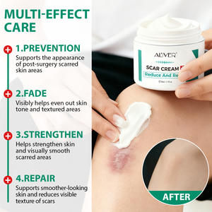 Crème réparatrice de vergetures et de cicatrices anciennes en silicone ALIVER, crème <span class=keywords><strong>anti</strong></span>-cicatrices avancée contre les taches de rousseur pour tous les types de peau - Product Image 3