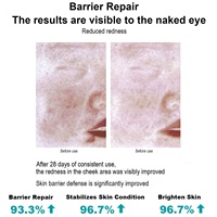 Soins de la peau après la chirurgie plastique au laser Patch de guérison de l'hémostase de la petite plaie coupée Pansement médical de soin des brûlures Gel de collagène de type III