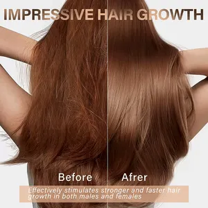 Private Label Raw Batana Oil Vitamin E Natural Biotin Fast Hair Growth Oil For Woman