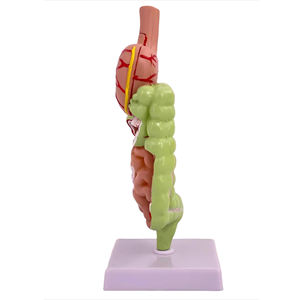 แบบจำลองการสอนทางการแพทย์ รุ่นลำไส้ใหญ่และโรคทางระบบทางเดินอาหาร - Product Image 2