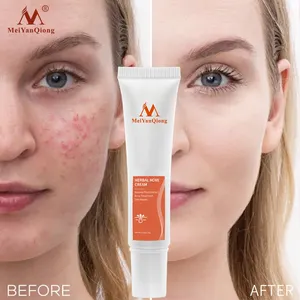 MeiYanQiong Herbal Acne Removal Face Cream Anti Acne Treatment Cream Skin Care Anti Inflammatory Lotion Face Cream