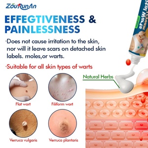 ZouRunAn Skin Herbal Extract <strong>Genital</strong> <strong>Warts</strong> Removal Ointment <strong>Genital</strong> <strong>Wart</strong> Relief Cream 6 Months Shelf Life - Product Image 3
