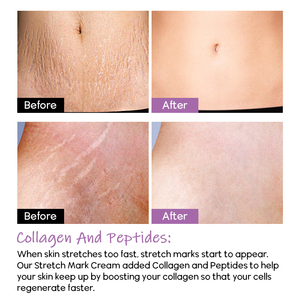 Crème et Lotion <span class=keywords><strong>Anti</strong></span>-Vergetures <span class=keywords><strong>Grossesse</strong></span> en Gros Marque Blanche pour Soins de la Peau - Product Image 4