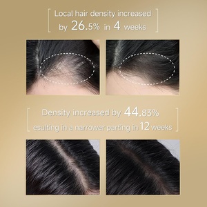 Shampoing Bio Nourrissant <span class=keywords><strong>Anti</strong></span>-Pelliculaire et Repoussant pour la Repousse des <span class=keywords><strong>Cheveux</strong></span>, Clarifiant, <span class=keywords><strong>Anti</strong></span>-<span class=keywords><strong>Chute</strong></span>, Rafraîchissant et Épaississant – Vente en Gros - Product Image 4