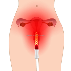 Perangkat terapi lampu merah, alat terapi ginekologi LED pengobatan penyakit ginekologi Wanita perawatan pribadi vagina - Product Image 5