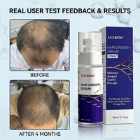 Sérum de repousse des cheveux à base de plantes, Anagain & ingrédients actifs doux, Redensyl, Capixyl, Procapil, Complexe de caféine, Bloqueur de DHT pour les cheveux