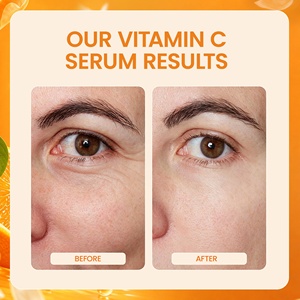 Suero Antienvejecimiento de Doble Acción con Vitamina C Sin Enjuague OEM - 20% Vitamina C y Ácido Ferúlico, Tratamiento Iluminador y Reafirmante para <span class=keywords><strong>el</strong></span> <span class=keywords><strong>Rostro</strong></span> - Product Image 6