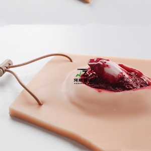 2025新しい外傷シミュレーション傷応急処置トレーニングモデル-手足の開いた骨折傷モデル-医療トレーニングモデル - Product Image 2