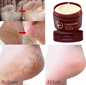 Crème hydratante et confortable pour les mains, les pieds et les talons secs à l'huile de <span class=keywords><strong>cheval</strong></span> en gros – En stock - Product Image 2