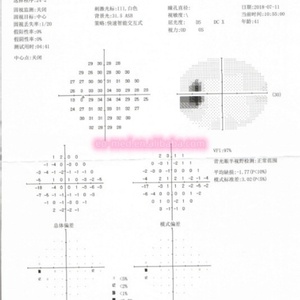 EOBIO11 - Instrumento Oftalmológico para Examen de la Vista al Precio Más Económico, Perímetro de Proyección para Pruebas Oculares - Product Image 6