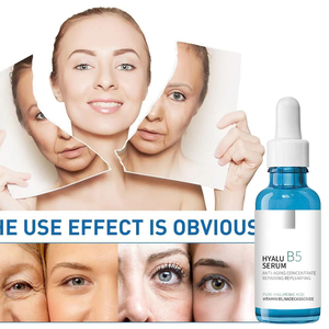 Suero Facial Orgánico de Fábrica de 30 ml, Antiarrugas, Antienvejecimiento, Control de Grasa, Reparación de Colágeno, Aclarante, para Mujeres - Product Image 3
