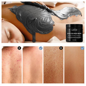 <span class=keywords><strong>Maschera</strong></span> <span class=keywords><strong>Viso</strong></span> <span class=keywords><strong>al</strong></span> Fango del Mar Morto GUOCUI BIO TECH, Etichetta Privata, Naturale, Nutriente, Lenitiva, Rimuove i Punti Neri, Purifica i Pori - Product Image 4