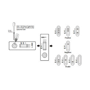 Emballage personnalisable Vivatest HSV 1/ 2 Igg Igm test Kit <span class=keywords><strong>Herpes</strong></span> Simplex Virus Test à domicile Kit marqué CE - Product Image 3