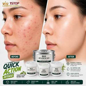 Crème pour le visage à l'<span class=keywords><strong>acide</strong></span> <span class=keywords><strong>hyaluronique</strong></span> et aux céramides, pour peaux sujettes à l'acné, crème éclaircissante et anti-imperfections sans <span class=keywords><strong>effets</strong></span> <span class=keywords><strong>secondaires</strong></span> - Product Image 1