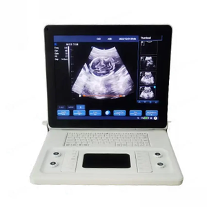 Draagbare Kleuren Doppler Veterinaire Echografie Diagnostisch Instrument Medische <span class=keywords><strong>Laptop</strong></span> Scanner 2-11MHz <span class=keywords><strong>Transducer</strong></span> 8-12 Uur Batterij - Product Image 6