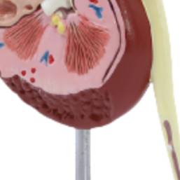 Modelo de Riñón de Tamaño Natural ADA de Doble Cara (Normal y con Patologías) A739, Modelo Anatómico para Ciencias Médicas y Escuelas - Product Image 4