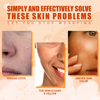 Soin Éclaircissant et Hydratant à la Vitamine C, Anti-Taches d'Acné, à l'Acide Hyaluronique et au Collagène, Favorisant l'Éclat de la Peau (Marque Blanche)