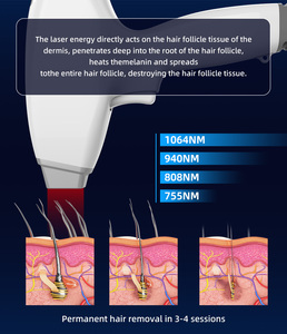 Meilleure machine d'épilation au laser à diode portable 4 ondes 808nm, épilation au laser indolore - Product Image 4