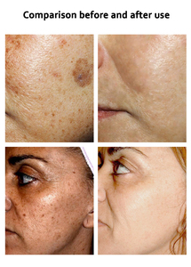 Crème COLLAGE Naturelle BLANCHE <span class=keywords><strong>EXTRA</strong></span> BLANCHISSANTE RAJEUNISSANTE HYDRATANTE Élimine les Taches Brunes et les Rougeurs - Product Image 3