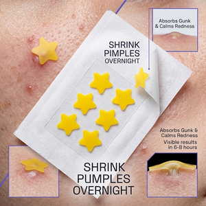 Parches para el Acné StarCare, Parches Hidrocoloides con Diseño de Estrella para una Curación Rápida, Diseño Invisible, Suministro de Fábrica OEM/ODM - Product Image 3