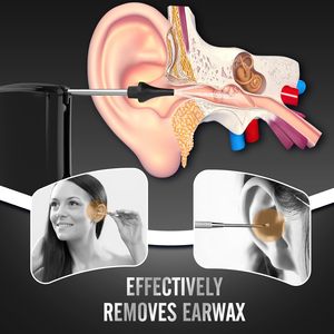Kit de lavage d'oreilles pour adultes à usage domestique, nettoyeur de cérumen hydrodynamique avec prise américaine, rinçage d'oreilles avec <span class=keywords><strong>eau</strong></span>, vente <span class=keywords><strong>chaude</strong></span> - Product Image 3