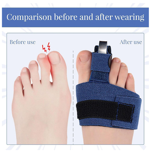 Ayarlanabilir ayak Splints doğrultma çekiç ayak desteği nefes dayanıklı erkekler & kadınlar için kırık ayak desteği yaralanmaları burkulmalar - Product Image 6