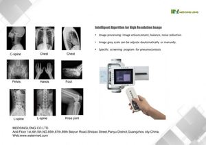 <span class=keywords><strong>New</strong></span> U cánh tay kỹ thuật số <span class=keywords><strong>x</strong></span> <span class=keywords><strong>Ray</strong></span> máy với 32kw 50kw 65kw 80kw chụp <span class=keywords><strong>X</strong></span> quang hệ thống điện nguồn điện - Product Image 5