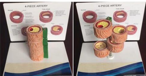 Modelo Anatómico de Arteriosclerosis de 4 Etapas, Material PVC, Modelo Educativo para Escuelas - Product Image 2