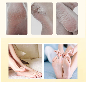 Crema Riparatrice per Piedi con Logo Personalizzato, Basso MOQ, Anti-Secchezza e Screpolature, Idratante Intensiva e Sbiancante - Product Image 4