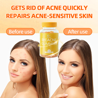 Expédié en 2 Jours DUOZI Gummies Anti-Acné Soin de la Peau Collagène Vitamines Gummies Capsule Gluta Meilleur Éclaircissant pour la Peau