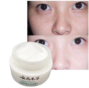 Crème éclaircissante et anti-taches à base de plantes du Yunnan, capable d'éclaircir le mélasma, les taches solaires, les cicatrices d'acné, la peau terne et de redonner de l'éclat à la peau - Product Image 3