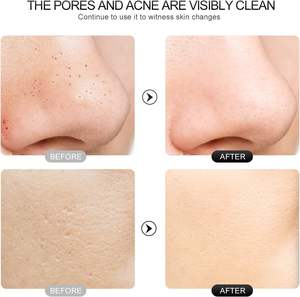 Esfoliador <span class=keywords><strong>Facial</strong></span> de Aço Inoxidável Removedor de Cravos 4 Modos Elétrico Portátil Ion Import EMS Máquina de Esfoliação <span class=keywords><strong>Facial</strong></span> Sonic - Product Image 6