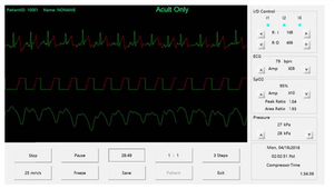 Dispositivo de contrapulsación externo PSK, <span class=keywords><strong>EECP</strong></span> - Product Image 3