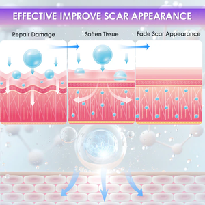 Private Label Geavanceerde Siliconen Littekengel Medische Kwaliteit Striae Brandt Keloïde Acne Littekens Verwijderaar <span class=keywords><strong>Gel</strong></span> Voor Oude En Nieuwe Littekens - Product Image 5