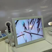Analyseur professionnel du cuir chevelu, microscope capillaire, détecteur de follicules pileux, test de perte de cheveux, analyseur de cuir chevelu et de peau