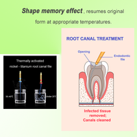 Limes endodontiques rotatives électriques en Nickel-Titane Ai Oral, compatibles turbine, coupe lisse, qualité A+, certifiées CE ISO Classe I